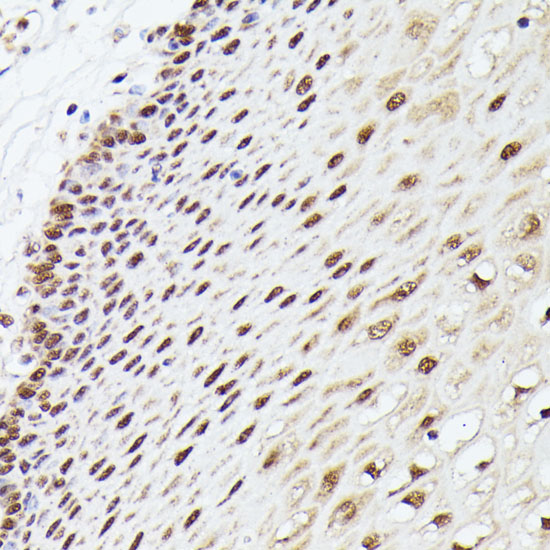 Anti-MLF2 Antibody (CAB16076)