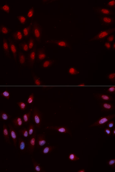 Anti-Phospho-CHEK1-S317 Antibody (CABP0018)