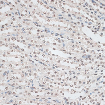 Anti-ZNF177 Antibody (CAB14802)