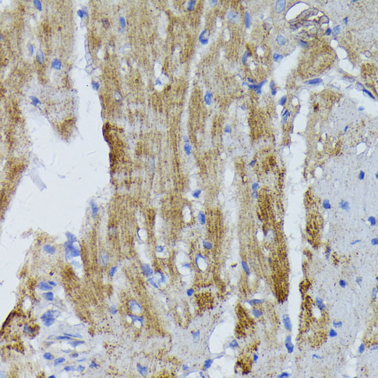 Anti-ACADL Antibody (CAB1266)