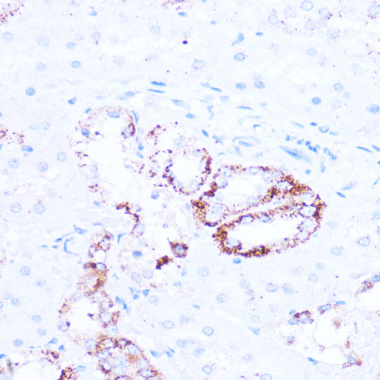 Anti-SIRT3 Antibody [KO Validated] (CAB5718)