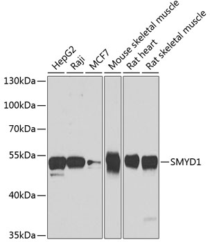 Anti-SMYD1 Antibody (CAB7308)