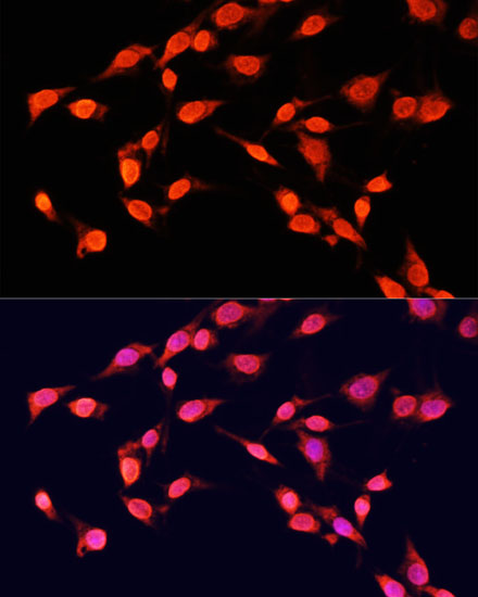 Anti-TriMethyl-Histone H3-K14 Antibody (CAB5279)