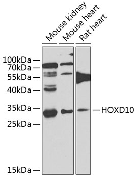 Anti-HOXD10 Antibody (CAB7686)