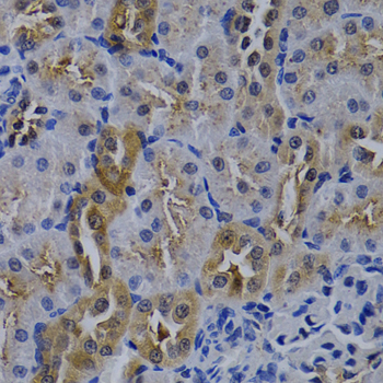 Anti-TNFRSF6B Antibody (CAB0649)