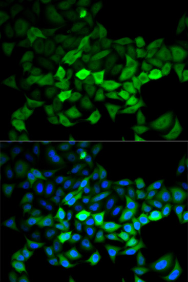 Anti-UBE2C Antibody (CAB5499)