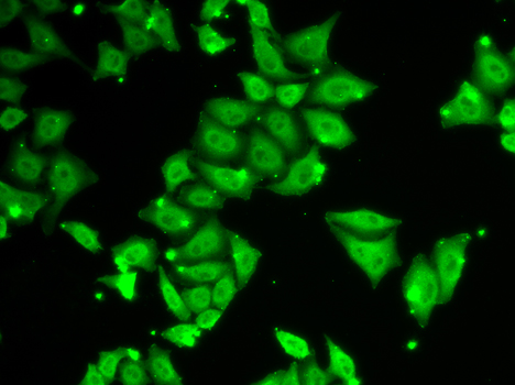 Anti-Ataxin 3 Antibody (CAB1243)