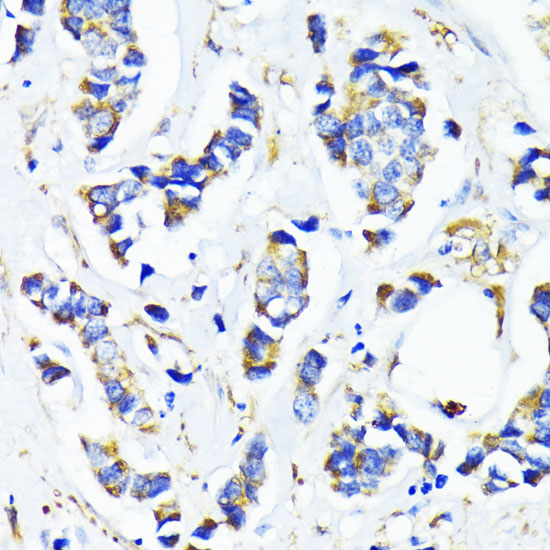 Anti-MRPL45 Antibody (CAB13197)