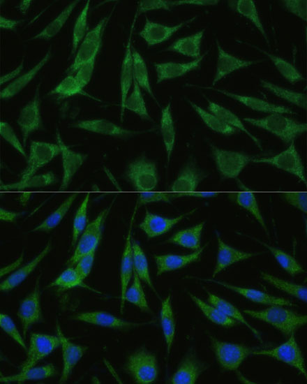 Anti-RHBDD1 Antibody (CAB14350)