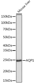 Anti-AQP1 Antibody (CAB4195)