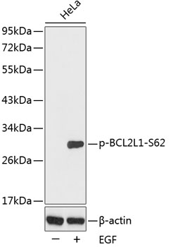 Anti-Phospho-BCL2L1-S62 Antibody (CABP0314)