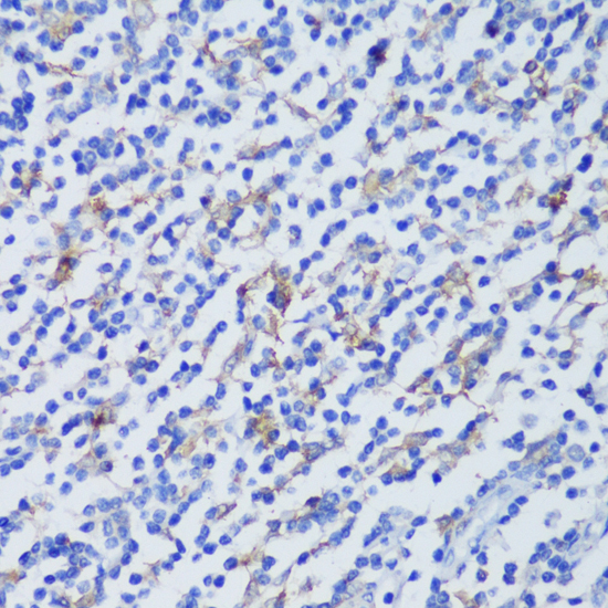 Anti-EFHD2 Antibody (CAB14926)