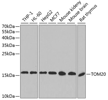 Anti-TOM20 Antibody (CAB6774)