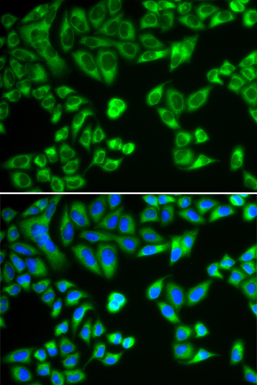 Anti-SH2B1 Antibody (CAB5564)