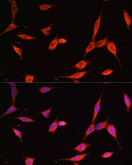 Anti-PIK3R3 Antibody (CAB17322)