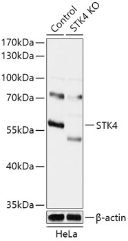 Anti-STK4 Antibody [KO Validated] (CAB18100)