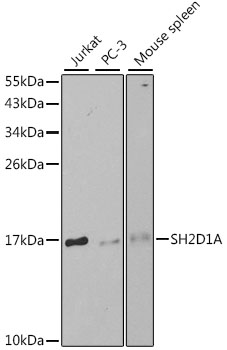 Anti-SH2D1A Antibody (CAB1143)