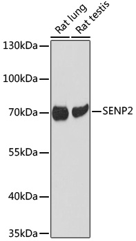 Anti-SENP2 Antibody (CAB17994)