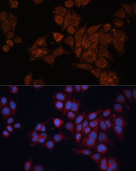 Anti-ALDH6A1 Antibody (CAB14750)