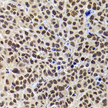 Anti-PHIP Antibody (CAB7207)