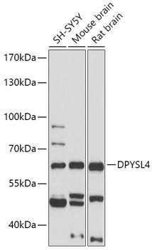 Anti-DPYSL4 Antibody (CAB17615)