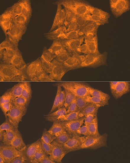 Anti-PFKL Antibody (CAB7708)