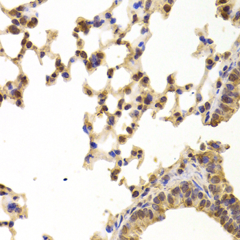 Anti-PPP2R1B Antibody (CAB6703)