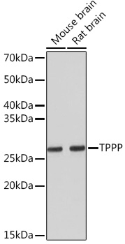 Anti-TPPP Antibody (CAB4637)