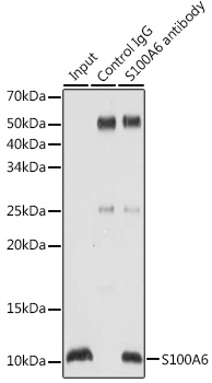 Anti-S100A6 Antibody [KO Validated] (CAB4104)