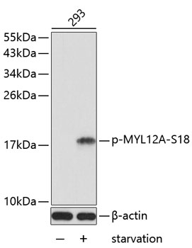 Anti-Phospho-MYL12A-S18 Antibody (CABP0412)