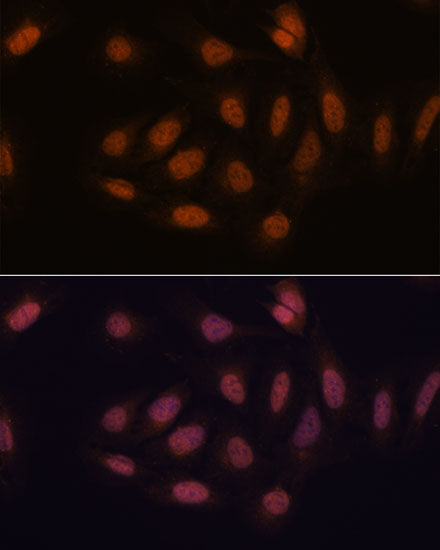 Anti-SNIP1 Antibody (CAB16747)