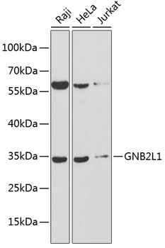 Anti-GNB2L1 Antibody (CAB13393)