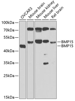 Anti-BMP15 Antibody (CAB7321)
