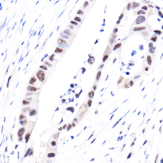 Anti-Phospho-YAP1-S127 Antibody (CABP0489)