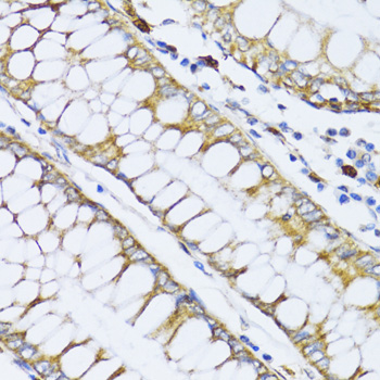 Anti-ALOX12 Antibody (CAB14703)