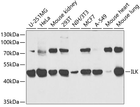 Anti-ILK Antibody (CAB0901)