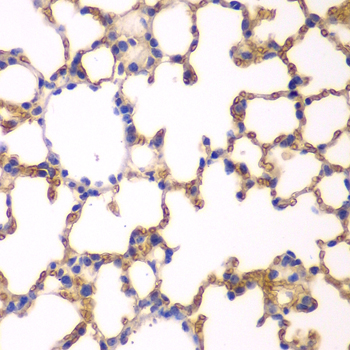 Anti-EPB41 Antibody (CAB12434)