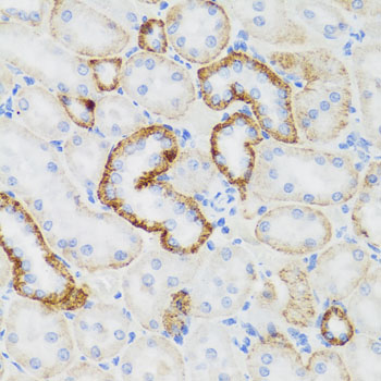 Anti-NEFH Polyclonal Antibody (CAB8442)