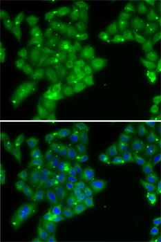 Anti-GCK Antibody (CAB6293)