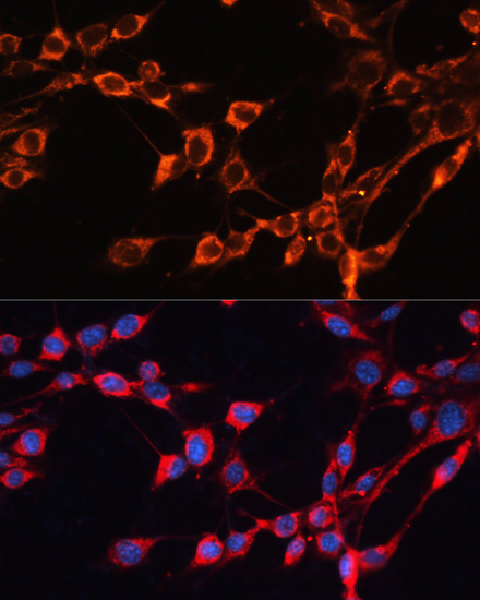 Anti-SLC25A24 Antibody (CAB12138)