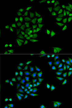 Anti-CYP2C9 Antibody (CAB6219)