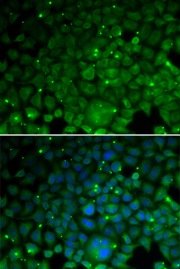 Anti-CRYAA Antibody (CAB5725)