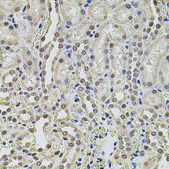 Anti-SMARCC2 Antibody (CAB1967)