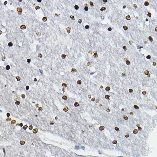 Anti-SOX10 Polyclonal Antibody (CAB8635)