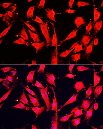 Anti-AOC1 Antibody (CAB6249)