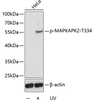 Anti-Phospho-MAPKAPK2-T334 Antibody (CABP0396)