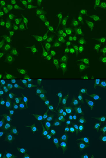 Anti-KLF4 Antibody (CAB6640)