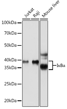 Anti-IkBAlpha Rabbit Monoclonal Antibody (CAB19714)