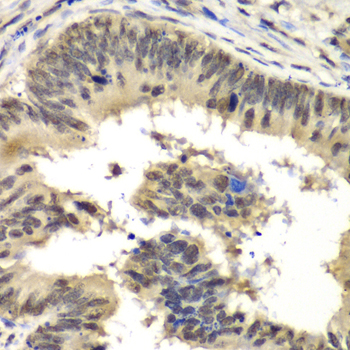 Anti-RBBP5 Antibody (CAB6965)