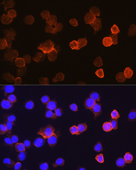 Anti-CD14 Antibody (CAB5737)